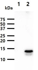 WB analysis of various samples using GTX57597 FABP9 antibody. Lane 1 : 293T cell lysate Lane 2 : FABP9 transfected 293T cell lysate Loading : 40 microg Dilution : 1:1000 WB analysis of various samples using GTX57597 FABP9 antibody. Lane 1 : 293T cell lysate Lane 2 : FABP9 transfected 293T cell lysate Loading : 40 microg Dilution : 1:1000