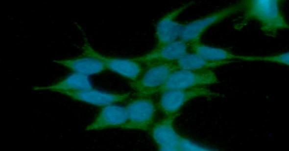 ICC/IF analysis of 293T cells using GTX57598 HIP antibody. Blue: DAPI Green: Primary antibody Dilution: 1:100