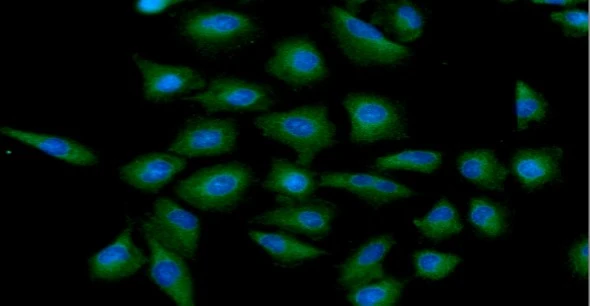 ICC/IF analysis of A549 cells using GTX57598 HIP antibody. Blue: DAPI Green: Primary antibody Dilution: 1:100