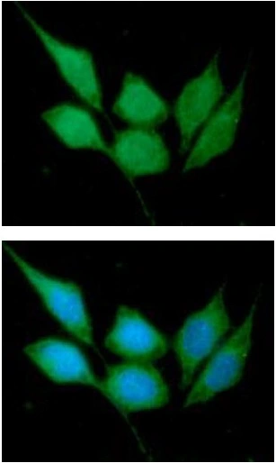 ICC/IF analysis of PC-3 cells using GTX57600 CacyBP antibody. Blue: DAPI Green: Primary antibody Dilution: 1:100 ICC/IF analysis of PC-3 cells using GTX57600 CacyBP antibody. Blue: DAPI Green: Primary antibody Dilution: 1:100