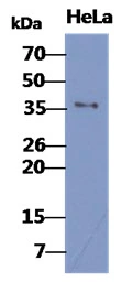 WB analysis of HeLa whole cell lysate using GTX57601 BUB3 antibody. Loading : 40 microg Dilution : 1:1000 WB analysis of HeLa whole cell lysate using GTX57601 BUB3 antibody. Loading : 40 microg Dilution : 1:1000