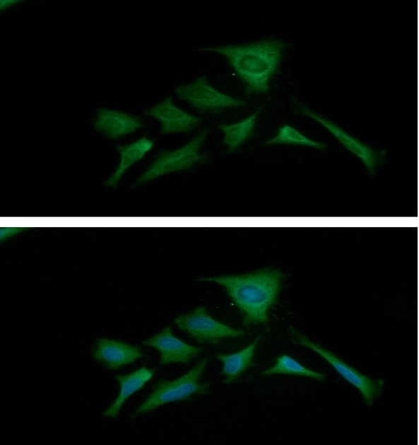 ICC/IF analysis of HeLa cells using GTX57604 PKM antibody. Blue: DAPI Green: Primary antibody Dilution: 1:100
