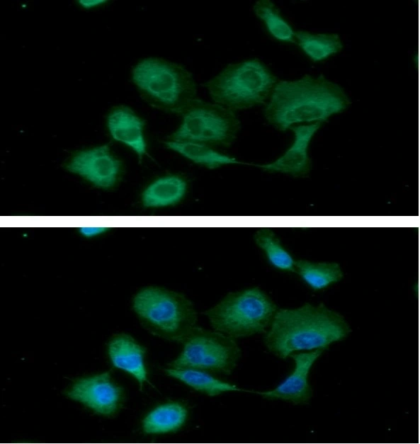 ICC/IF analysis of A549 cells using GTX57604 PKM antibody. Blue: DAPI Green: Primary antibody Dilution: 1:100 ICC/IF analysis of A549 cells using GTX57604 PKM antibody. Blue: DAPI Green: Primary antibody Dilution: 1:100