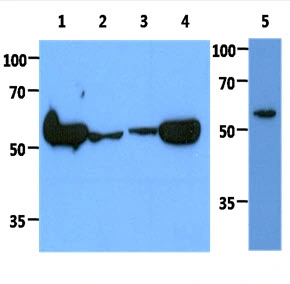 WB analysis of various samples using GTX57604 PKM antibody. Lane 1 : HeLa whole cell lysate Lane 2 : Jurkat whole cell lysate Lane 3 : MCF-7 whole cell lysate Lane 4 : A549 whole cell lysate Lane 5 : 293T whole cell lysate Dilution : 1:1000 WB analysis of various samples using GTX57604 PKM antibody. Lane 1 : HeLa whole cell lysate Lane 2 : Jurkat whole cell lysate Lane 3 : MCF-7 whole cell lysate Lane 4 : A549 whole cell lysate Lane 5 : 293T whole cell lysate Dilution : 1:1000