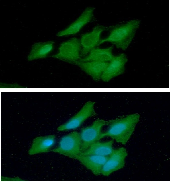 ICC/IF analysis of HeLa cells using GTX57605 RAIDD antibody. Blue: DAPI Green: Primary antibody Dilution: 1:100 ICC/IF analysis of HeLa cells using GTX57605 RAIDD antibody. Blue: DAPI Green: Primary antibody Dilution: 1:100