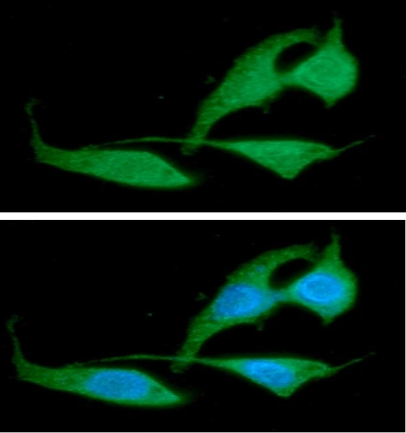 ICC/IF analysis of PC-3 cells using GTX57605 RAIDD antibody. Blue: DAPI Green: Primary antibody Dilution: 1:100