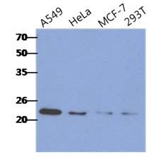 WB analysis of various samples using GTX57605 RAIDD antibody. Samples : A549, HeLa, MCF-7 and 293T whole cell lysate Loading : 40 microg Dilution : 1:500
