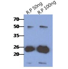 WB analysis of Recombinant Human CRADD protein using GTX57605 RAIDD antibody. Loading : 50 and 100 ng Dilution : 1:1000