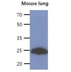 WB analysis of Mouse lung tissue lysate using GTX57606 CREG1 antibody. Loading : 40 microg Dilution : 1:1000 WB analysis of Mouse lung tissue lysate using GTX57606 CREG1 antibody. Loading : 40 microg Dilution : 1:1000