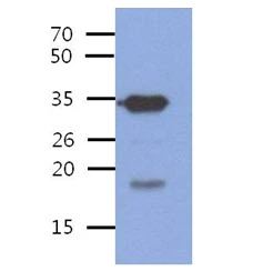 WB analysis of Recombinant Human PDCL3 protein using GTX57608 PDCL3 antibody. Loading : 100 ng Dilution : 1:1000