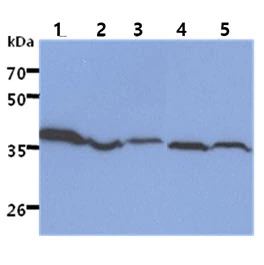 WB analysis of various samples using GTX57610 ACAT2 antibody. Lane 1 : HepG2 whole cell lysate Lane 2 : Ramos whole cell lysate Lane 3 : MCF-7 whole cell lysate Lane 4 : 293T whole cell lysate Lane 5 : HL-60 whole cell lysate Lane 6 : SW480 whole cell lysate Loading : 40 microg Dilution : 1:1000