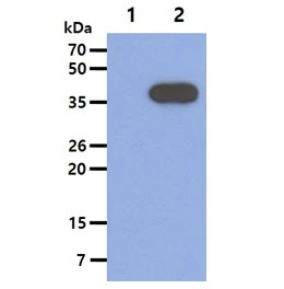 WB analysis of various samples using GTX57610 ACAT2 antibody. Lane 1 : 293T cell lysate Lane 2 : ACAT2 transfected 293T cell lysate Loading : 5 microg Dilution : 1:1000