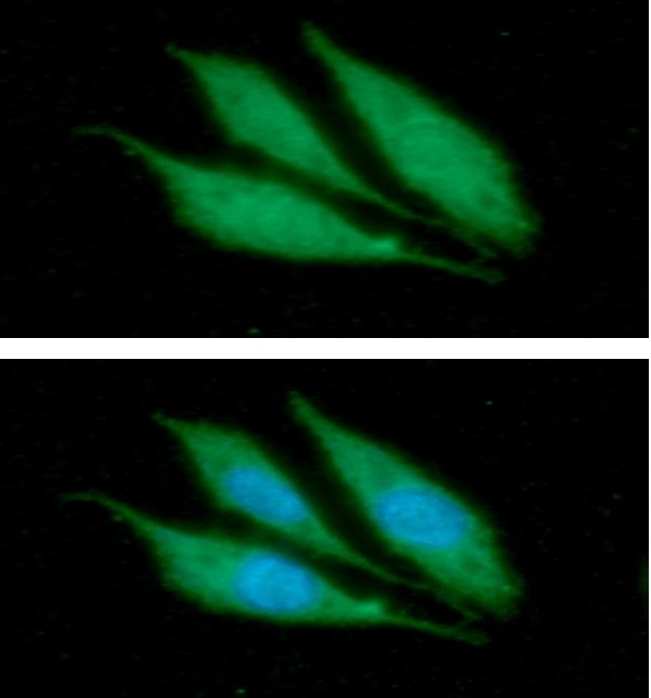 ICC/IF analysis of PC-3 cells using GTX57611 Cytokeratin 14 antibody. Blue: DAPI Green: Primary antibody Dilution: 1:100