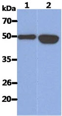 WB analysis of various samples using GTX57611 Cytokeratin 14 antibody. Lane 1 : Recombinant Human KRT14 Lane 2 : A431 whole cell lysate (40 microg)