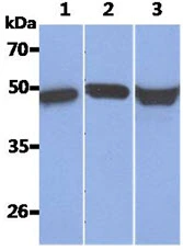 WB analysis of various samples using GTX57612 Cytokeratin 17 antibody. Lane 1 : Recombinant Human KRT17 Lane 2 : HeLa whole cell lysate (40 microg) Lane 3 : A431 whole cell lysate (40 microg)