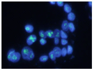 ICC/IF analysis of WiDr cells using GTX57613 Nucleophosmin antibody. Blue: DAPI Green: Primary antibody Dilution: 1:200