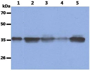 WB analysis of various samples using GTX57613 Nucleophosmin antibody. Lane 1 : Recombinant Human NPM1 protein (50 ng) Lane 2 : Jurkat whole cell lysate (40 microg) Lane 3 : 293T whole cell lysate (40 microg) Lane 4 : HeLa whole cell lysate (40 microg) Lane 5 : HepG2 whole cell lysate (40 microg)