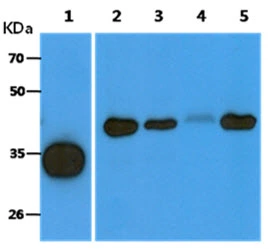 WB analysis of various samples using GTX57615 ACOT8 antibody. Lane 1 : Recombinant Human ACOT8 protein (10 ng) Lane 2 : Ramos whole cell lysate (40 microg) Lane 3 : A431 whole cell lysate (40 microg) Lane 4 : 293T whole cell lysate (40 microg) Lane 5 : A549 whole cell lysate (40 microg)