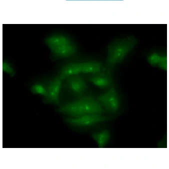 ICC/IF analysis of A549 cells using GTX57616 COMMD7 antibody. Green: Primary antibody Dilution: 1:100 ICC/IF analysis of A549 cells using GTX57616 COMMD7 antibody. Green: Primary antibody Dilution: 1:100