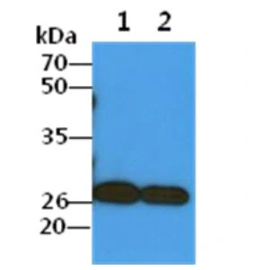 WB analysis of various samples using GTX57616 COMMD7 antibody. Lane 1 : A549 whole cell lysate Lane 2 : HepG2 whole cell lysate Loading : 40 microg Dilution : 1:1000