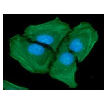 ICC/IF analysis of HeLa cells using GTX57619 alpha Smooth Muscle Actin antibody. Blue: DAPI Green: Primary antibody Dilution: 1:100