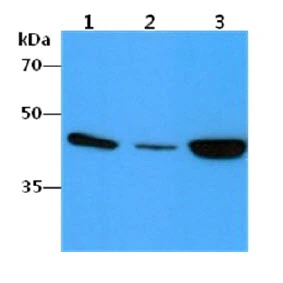 WB analysis of various samples using GTX57619 alpha Smooth Muscle Actin antibody. Lane 1 : HepG2 whole cell lysate Lane 2 : SW480 whole cell lysate Lane 3 : HeLa whole cell lysate Loading : 40 microg Dilution : 1:1000
