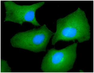 ICC/IF analysis of HeLa cells using GTX57621 Fascin 1 antibody. Blue: DAPI Green: Primary antibody Dilution: 1:100