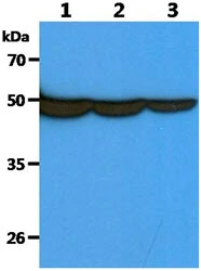 WB analysis of various samples using GTX57621 Fascin 1 antibody. Lane 1 : HeLa whole cell lysate Lane 2 : HepG2 whole cell lysate Lane 3 : THP-1 whole cell lysate Loading : 40 microg Dilution : 1:1000