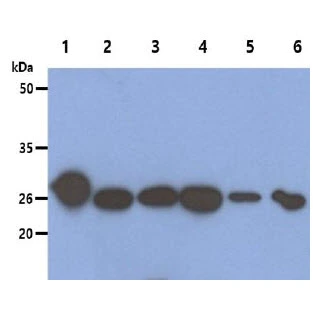 WB analysis of various samples using GTX57622 Peroxiredoxin 6 antibody. Lane 1 : Recombinant Human PRDX6 protein (50 ng) Lane 2 : HeLa whole cell lysate (40 microg) Lane 3 : 293T whole cell lysate (40 microg) Lane 4 : HepG2 whole cell lysate (40 microg) Lane 5 : U87-MG whole cell lysate (40 microg) Lane 6 : Ramos whole cell lysate (40 microg)