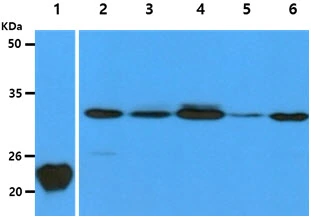 WB analysis of various samples using GTX57626 Calpain S1 antibody. Lane 1 : Recombinant Human CAPNS1 protein (50 ng) Lane 2 : HeLa whole cell lysate (40 microg) Lane 3 : A431 whole cell lysate (40 microg) Lane 4 : 293T whole cell lysate (40 microg) Lane 5 : Balb/3T3 whole cell lysate (40 microg) Lane 6 : U87-MG whole cell lysate (40 microg)