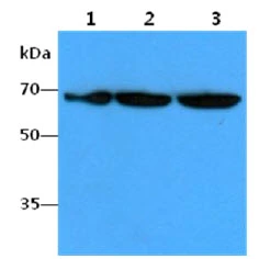 WB analysis of various samples using GTX57628 FUBP1 antibody. Lane 1 : HeLa whole cell lysate Lane 2 : HepG2 whole cell lysate Lane 3 : Jurkat whole cell lysate Loading : 40 microg Dilution : 1:1000