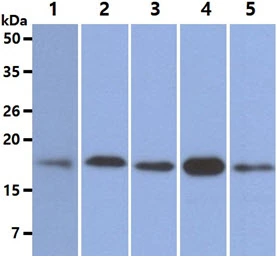 WB analysis of various samples using GTX57631 MTH1 antibody. Lane 1 : K562 whole cell lysate Lane 2 : SW480 whole cell lysate Lane 3 : THP-1 whole cell lysate Lane 4 : Jurkat whole cell lysate Lane 5 : A549 whole cell lysate Loading : 40 microg Dilution : 1:500
