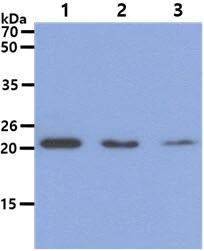 WB analysis of various samples using GTX57632 DHFR antibody. Lane 1 : HeLa whole cell lysate Lane 2 : Jurkat whole cell lysate Lane 3 : 293T whole cell lysate Loading : 40 microg Dilution : 1:1000