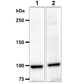 WB analysis of various samples using GTX57633 alpha Actinin 1 antibody. Lane 1 : PC-3 whole cell lysate Lane 2 : A549 whole cell lysate Loading : 40 microg Dilution : 1:1000