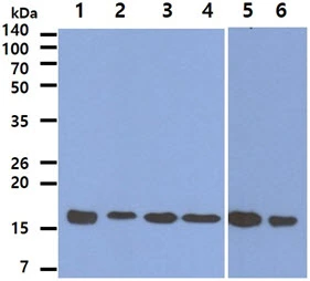 WB analysis of various samples using GTX57635 Peroxiredoxin 5 antibody. Lane 1 : Recombinant Human PRDX5 protein (50 ng) Lane 2 : MCF-7 whole cell lysate (40 microg) Lane 3 : A549 whole cell lysate (40 microg) Lane 4 : HeLa whole cell lysate (40 microg) Lane 5 : 293T whole cell lysate (40 microg) Lane 6 : Jurkat whole cell lysate (40 microg)