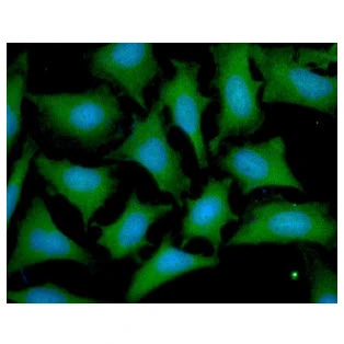 ICC/IF analysis of HeLa cells using GTX57636 OTUB1 antibody. Blue: DAPI Green: Primary antibody Dilution: 1:100 ICC/IF analysis of HeLa cells using GTX57636 OTUB1 antibody. Blue: DAPI Green: Primary antibody Dilution: 1:100