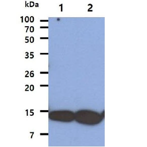 WB analysis of various samples using GTX57638 AHA-1 antibody. Lane 1 : A431 whole cell lysate Lane 2 : HeLa whole cell lysate Loading : 40 microg Dilution : 1:1000