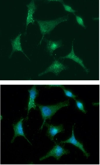 ICC/IF analysis of A549 cells using GTX57640 S100A4 antibody. Blue: DAPI Green: Primary antibody Dilution: 1:100