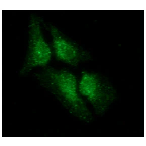 ICC/IF analysis of HeLa cells using GTX57641 26347 antibody. Blue: DAPI Green: Primary antibody Dilution: 1:100 ICC/IF analysis of HeLa cells using GTX57641 26347 antibody. Blue: DAPI Green: Primary antibody Dilution: 1:100