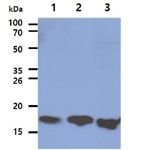 WB analysis of various samples using GTX57641 26347 antibody. Lane 1 : HeLa whole cell lysate Lane 2 : K562 whole cell lysate Lane 3 : Jurkat whole cell lysate Loading : 40 microg Dilution : 1:1000