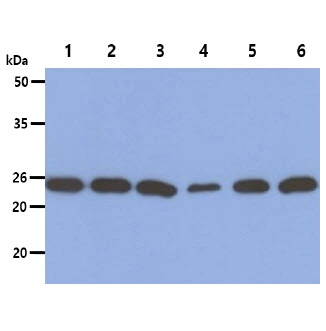 WB analysis of various samples using GTX57642 PSMD10 antibody. Lane 1 : A549 whole cell lysate Lane 2 : PC-3 whole cell lysate Lane 3 : K562 whole cell lysate Lane 4 : HepG2 whole cell lysate Lane 5 : HeLa whole cell lysate Lane 6 : Jurkat whole cell lysate Loading : 40 microg Dilution : 1:1000