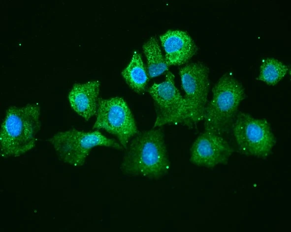ICC/IF analysis of Hep3B cells using GTX57644 AHA-1 antibody. Blue: DAPI Green: Primary antibody Dilution: 1:100 ICC/IF analysis of Hep3B cells using GTX57644 AHA-1 antibody. Blue: DAPI Green: Primary antibody Dilution: 1:100