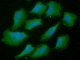 ICC/IF analysis of A549 cells using GTX57644 AHA-1 antibody. Blue: DAPI Green: Primary antibody Dilution: 1:100