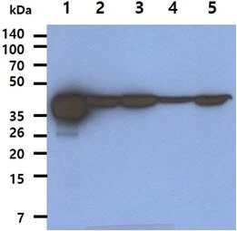 WB analysis of various samples using GTX57644 AHA-1 antibody. Lane 1 : Recombinant Human AHA1 protein (50 ng) Lane 2 : MCF-7 whole cell lysate (40 microg) Lane 3 : PC-3 whole cell lysate (40 microg) Lane 4 : 293T whole cell lysate (40 microg) Lane 5 : HeLa whole cell lysate (40 microg)