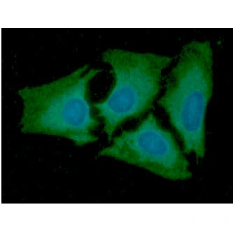 ICC/IF analysis of HeLa cells using GTX57648 Adenylate kinase 2 antibody. Blue: DAPI Green: Primary antibody Dilution: 1:100 ICC/IF analysis of HeLa cells using GTX57648 Adenylate kinase 2 antibody. Blue: DAPI Green: Primary antibody Dilution: 1:100