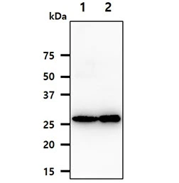 WB analysis of various samples using GTX57648 Adenylate kinase 2 antibody. Lane 1 : Human kidney tissue lysate Lane 2 : Human liver tissue lysate Loading : 40 microg Dilution : 1:1000