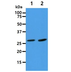 WB analysis of various samples using GTX57648 Adenylate kinase 2 antibody. Lane 1 : HepG2 whole cell lysate Lane 2 : NIH-3T3 whole cell lysate Loading : 40 microg Dilution : 1:1000