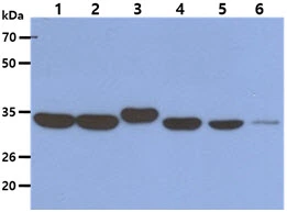 WB analysis of various samples using GTX57649 AIMP1 antibody. Lane 1 : HeLa whole cell lysate Lane 2 : HepG2 whole cell lysate Lane 3 : Raji whole cell lysate Lane 4 : Jurkat whole cell lysate Lane 5 : A549 whole cell lysate Lane 6 : HaCaT whole cell lysate Loading : 40 microg Dilution : 1:1000