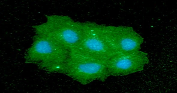 ICC/IF analysis of Hep3B cells using GTX57655 IMPA1 antibody. Blue: DAPI Green: Primary antibody Dilution: 1:100