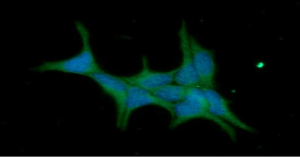 ICC/IF analysis of LNCap cells using GTX57655 IMPA1 antibody. Blue: DAPI Green: Primary antibody Dilution: 1:100
